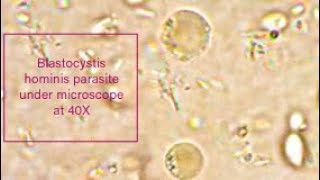 Blastocystis hominis parasite under microscope at 40X [upl. by Haveman]