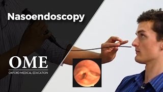 Nasoendoscopy Nose Examination  ENT [upl. by Iznek]