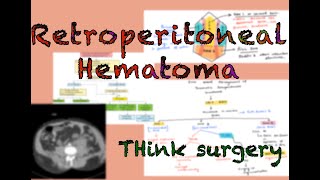 Retroperitoneal Hematoma and Management [upl. by Rainwater]