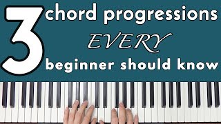 Common Chord Progressions Every Beginner Should Know [upl. by Elleinahc]