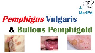 Vesiculobullous Skin Diseases  Pemphigus Vulgaris vs Bullous Pemphigoid [upl. by Malachy211]