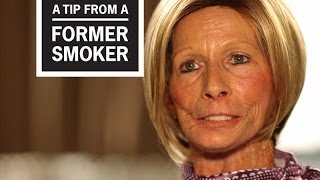 CDC Tips From Former Smokers  Terrie H Little Things I Miss [upl. by Eceerehs]