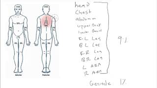 Understanding The Rule of Nines [upl. by Danais]