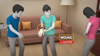 SAFE STEPS First Aid Severe Bleeding [upl. by Ynnej]