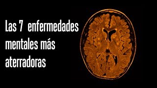 Las 7 enfermedades mentales más aterradoras [upl. by Sitof]