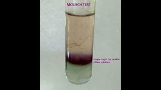 Molisch Testa group test for Carbohydrates [upl. by Rivalee]