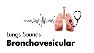 Bronchovesicular Breath Sounds  Lung Sounds  MEDZCOOL [upl. by Wystand357]