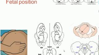 Fetal lie presentation and position [upl. by Llerol]