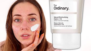 The Best Inexpensive Moisturizer  The Ordinary Natural Moisturizing Factors  HA Review [upl. by Sualkin892]