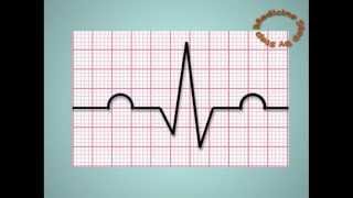 Understanding ECGs  EKG [upl. by Paxon468]