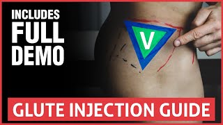 How To Do A Glute Injection  Full Guide And Demo [upl. by Ibed]