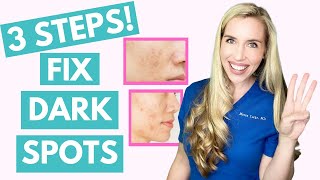 Fix Your Dark Spots in 3 Steps  Hyperpigmentation  Melasma  Skincare Made Simple [upl. by Link665]