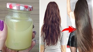 Como Fazer o CABELO CRESCER RÁPIDO em Uma Semana Com Apenas Dois Ingredientes [upl. by Maggy]