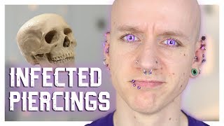 Infected Piercings amp How To Heal Them  Piercing FAQ 21  Roly [upl. by Trojan]