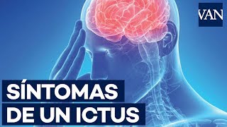 ¿Cuáles son los síntomas de un derrame cerebral [upl. by Harcourt]