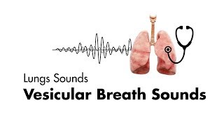 Vesicular Breath Sounds  Normal Lung Sounds  MEDZCOOL [upl. by Peg905]