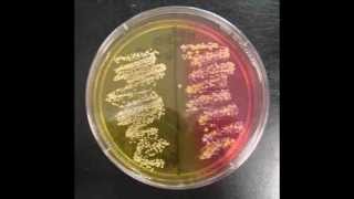 How to Interpret Mannitol Salt Agar Bacterial Growth Medium [upl. by Emmett]