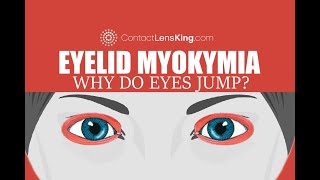 Eyelid Myokymia  Why do my eyes keep jumping [upl. by Iorio]