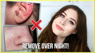 How To Get Rid Of Piercing Bumps OVERNIGHT [upl. by Ocsicnarf976]