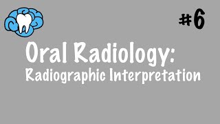 Oral Radiology  Radiographic Interpretation  INBDE ADAT [upl. by Eornom]