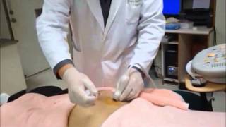 UltrasoundGuided Sacroiliac Joint Injection Technique [upl. by Oecile919]