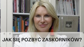 Jak się pozbyć zaskórników [upl. by Bryn128]