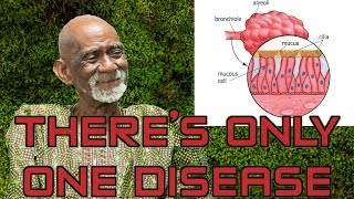 Dr Sebi Reveals Herbs For Mucus Removal [upl. by Rialcnis]