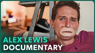 The Extraordinary Case of Alex Lewis [upl. by Nipha203]