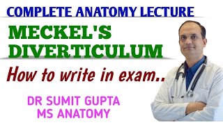 Meckels Diverticulum  Anatomy [upl. by Burger94]