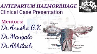 ANTEPARTUM HEAMORRHAGE Clinical Case Presentation [upl. by Leizo534]