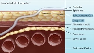 Peritoneal Cavity  Part 4  Intraperitoneal and Retroperitoneal Organs  Anatomy Tutorial [upl. by Fogel]