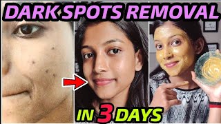 Remove DARK SPOTS NATURALLY in 3 Days 😍 Hyperpigmentation Acne Scars Brown Spots [upl. by Ominorej]