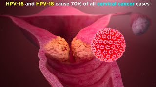 Human Papillomavirus HPV [upl. by Marou]