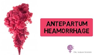 Antepartum Haemorrhage [upl. by Chastity]