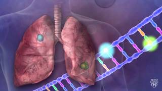 11 Cardiac markers Laboratory investigations in Myocardial Infarction amp Case discussion [upl. by Midian787]