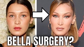 Jennifer Lopez Plastic Surgery 2020 [upl. by Riane]