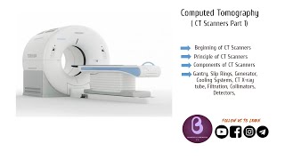 What to Expect From Your Open Upright MRI Exam [upl. by Lorraine]