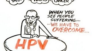 Diagnosis and Treatment of HPVPositive HNC [upl. by Kral]