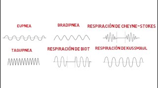 Patrones respiratorios Eupnea Bradipnea Taquipnea Biot CheyneStokes y Kussmaul [upl. by Putscher]