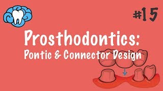 Prosthodontics  Pontic amp Connector Design  INBDE ADAT [upl. by Saunders186]