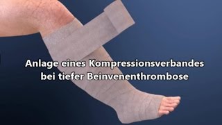 Kompressionsverband bei Thrombose [upl. by Atihana]