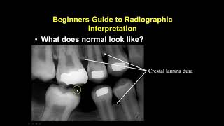 Radiographic Interpretation Section 1 [upl. by Maltz]